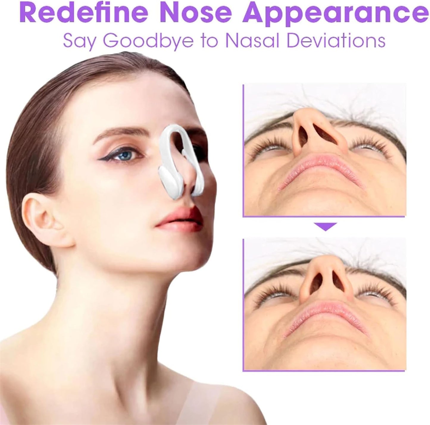 NOSELIFT Nose Sculpting Device