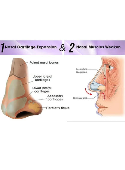 NOSELIFT Nose Sculpting Device
